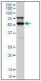 Serine/Threonine Kinase 17a antibody, AM20971PU-N, Origene, Western Blot image 