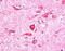 PITPNM Family Member 3 antibody, MBS421025, MyBioSource, Immunohistochemistry paraffin image 