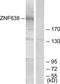Zinc Finger Protein 638 antibody, TA315382, Origene, Western Blot image 