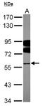 Far Upstream Element Binding Protein 3 antibody, NBP2-16544, Novus Biologicals, Western Blot image 