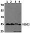 V-Set And Immunoglobulin Domain Containing 2 antibody, A15033-1, Boster Biological Technology, Western Blot image 