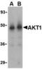Protein kinase B antibody, TA306225, Origene, Western Blot image 