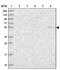 Prosaposin Like 1 (Gene/Pseudogene) antibody, NBP1-90903, Novus Biologicals, Western Blot image 