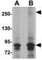 Jumonji Domain Containing 1C antibody, GTX85014, GeneTex, Western Blot image 