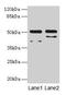 Corticotropin Releasing Hormone Receptor 1 antibody, CSB-PA005965EA01HU, Cusabio, Western Blot image 