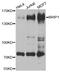 BRCA1 Interacting Protein C-Terminal Helicase 1 antibody, A01995-1, Boster Biological Technology, Western Blot image 