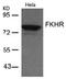 Forkhead Box O1 antibody, AP02666PU-N, Origene, Western Blot image 