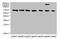 Transient Receptor Potential Cation Channel Subfamily M Member 2 antibody, CSB-PA007779LA01HU, Cusabio, Western Blot image 
