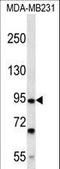 Fibronectin Type III And SPRY Domain Containing 2 antibody, LS-C166258, Lifespan Biosciences, Western Blot image 
