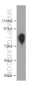 ANTXR Cell Adhesion Molecule 1 antibody, 15091-1-AP, Proteintech Group, Western Blot image 