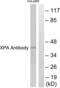 XPA, DNA Damage Recognition And Repair Factor antibody, LS-C118637, Lifespan Biosciences, Western Blot image 