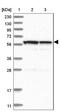 Chromosome 6 Open Reading Frame 118 antibody, NBP1-88726, Novus Biologicals, Western Blot image 