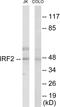 Interferon Regulatory Factor 2 antibody, EKC1678, Boster Biological Technology, Western Blot image 