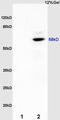 Melanocyte-stimulating hormone receptor antibody, orb10616, Biorbyt, Western Blot image 