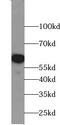 Zinc Finger Protein 154 antibody, FNab09660, FineTest, Western Blot image 