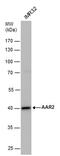 Protein AAR2 homolog antibody, PA5-78461, Invitrogen Antibodies, Western Blot image 