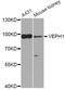 Ventricular Zone Expressed PH Domain Containing 1 antibody, A8510, ABclonal Technology, Western Blot image 