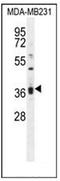 Kelch Like Family Member 35 antibody, AP52388PU-N, Origene, Western Blot image 