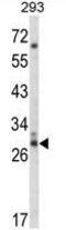 CDC42 Effector Protein 3 antibody, GTX81035, GeneTex, Western Blot image 