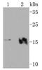 Vesicle Associated Membrane Protein 2 antibody, A02331-2, Boster Biological Technology, Western Blot image 