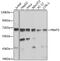Protein Arginine Methyltransferase 5 antibody, GTX32810, GeneTex, Western Blot image 