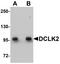 Doublecortin Like Kinase 2 antibody, LS-B4635, Lifespan Biosciences, Western Blot image 