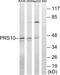 Proteasome 26S Subunit, ATPase 6 antibody, LS-C119606, Lifespan Biosciences, Western Blot image 