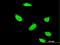 3'-Phosphoadenosine 5'-Phosphosulfate Synthase 1 antibody, H00009061-M05, Novus Biologicals, Immunocytochemistry image 