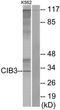 Calcium And Integrin Binding Family Member 3 antibody, TA316035, Origene, Western Blot image 