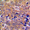 ABL Proto-Oncogene 1, Non-Receptor Tyrosine Kinase antibody, LS-C351779, Lifespan Biosciences, Immunohistochemistry frozen image 