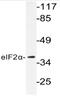 Eukaryotic translation initiation factor 2 subunit 1 antibody, AP20746PU-N, Origene, Western Blot image 