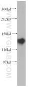 NODAL Modulator 2 antibody, 14328-1-AP, Proteintech Group, Western Blot image 