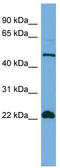 Hemogen antibody, TA344598, Origene, Western Blot image 