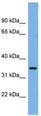 Phospholipid Scramblase 1 antibody, TA344740, Origene, Western Blot image 