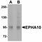 EPH Receptor A10 antibody, LS-C108549, Lifespan Biosciences, Western Blot image 