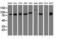 Diacylglycerol kinase beta antibody, NBP2-02733, Novus Biologicals, Western Blot image 