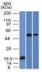 TOX High Mobility Group Box Family Member 3 antibody, orb388176, Biorbyt, Western Blot image 
