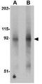 Folliculin-interacting protein 2 antibody, GTX85347, GeneTex, Western Blot image 