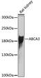 ATP Binding Cassette Subfamily A Member 3 antibody, 22-511, ProSci, Western Blot image 