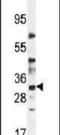 LysM Domain Containing 4 antibody, PA5-23927, Invitrogen Antibodies, Western Blot image 