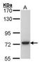 N-Sulfoglucosamine Sulfohydrolase antibody, GTX101700, GeneTex, Western Blot image 