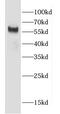 CCZ1 Homolog, Vacuolar Protein Trafficking And Biogenesis Associated antibody, FNab01405, FineTest, Western Blot image 