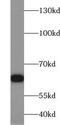 E3 ubiquitin-protein ligase TRIM32 antibody, FNab08980, FineTest, Western Blot image 