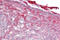 PFC antibody, ARP56381_P050, Aviva Systems Biology, Immunohistochemistry paraffin image 
