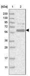 MAGE Family Member A10 antibody, NBP1-88045, Novus Biologicals, Western Blot image 