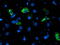 NADH:Ubiquinone Oxidoreductase Subunit A5 antibody, TA503881, Origene, Immunofluorescence image 