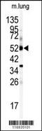Cytochrome P450 Family 1 Subfamily A Member 1 antibody, 63-322, ProSci, Western Blot image 