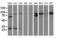 Catenin Beta 1 antibody, LS-C172671, Lifespan Biosciences, Western Blot image 