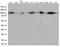 EWS RNA Binding Protein 1 antibody, LS-C793182, Lifespan Biosciences, Western Blot image 