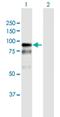 Bromodomain Adjacent To Zinc Finger Domain 2B antibody, H00029994-B01P, Novus Biologicals, Western Blot image 